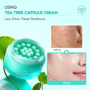 treatment acne face cream main image